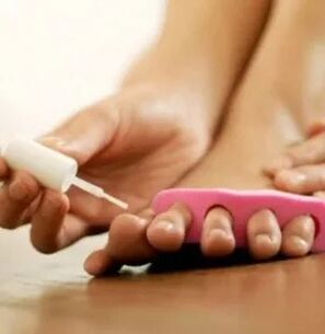 Terapeutilise laki rakendamine